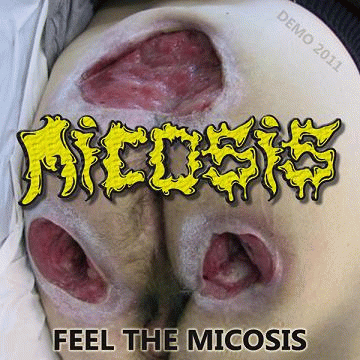 Micosis : Feel the Micosis